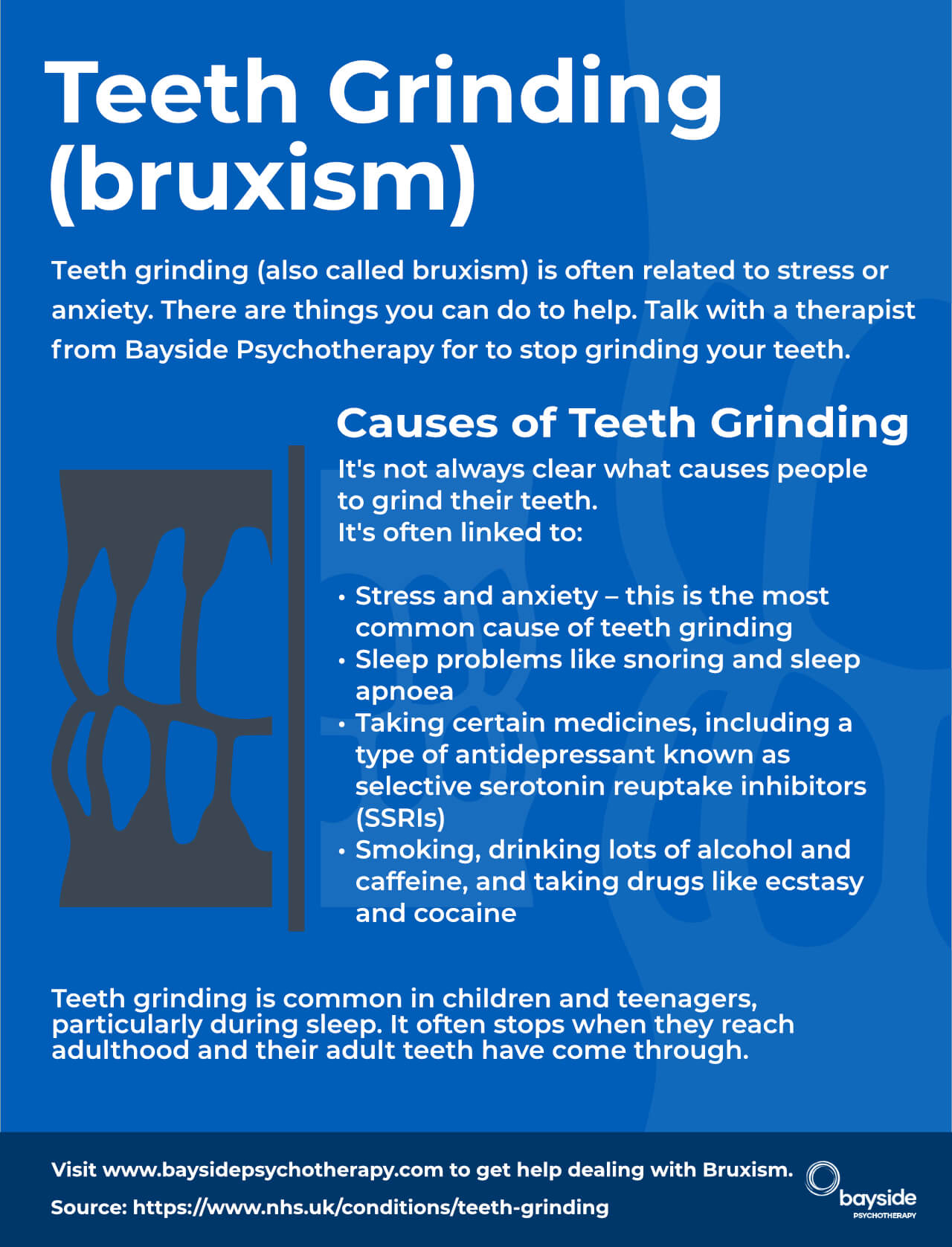 Causes Of Teeth Grinding Bruxism - Bayside Hypnotherapy